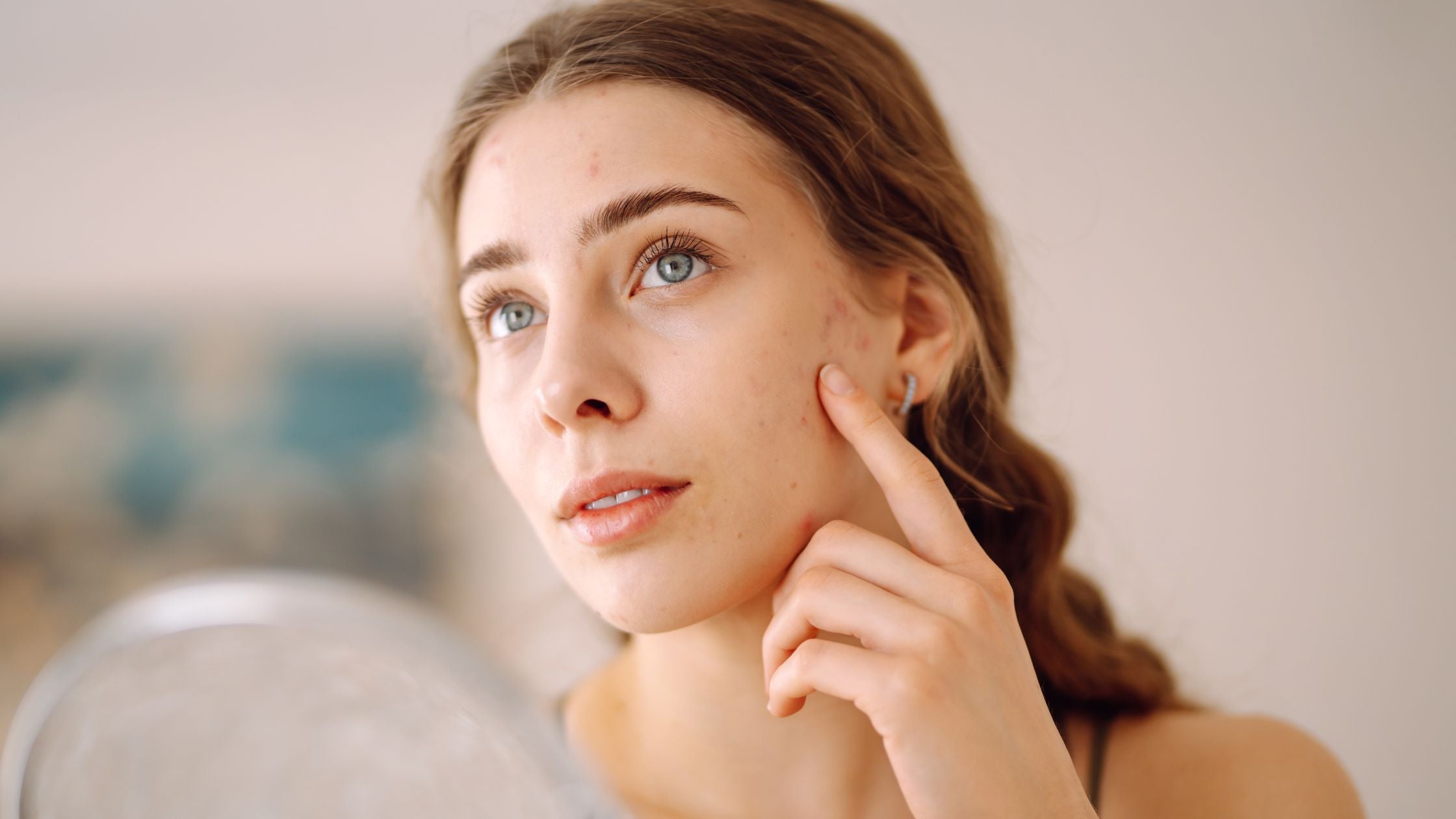 Best Way to Get Rid of Whiteheads on Face and Nose